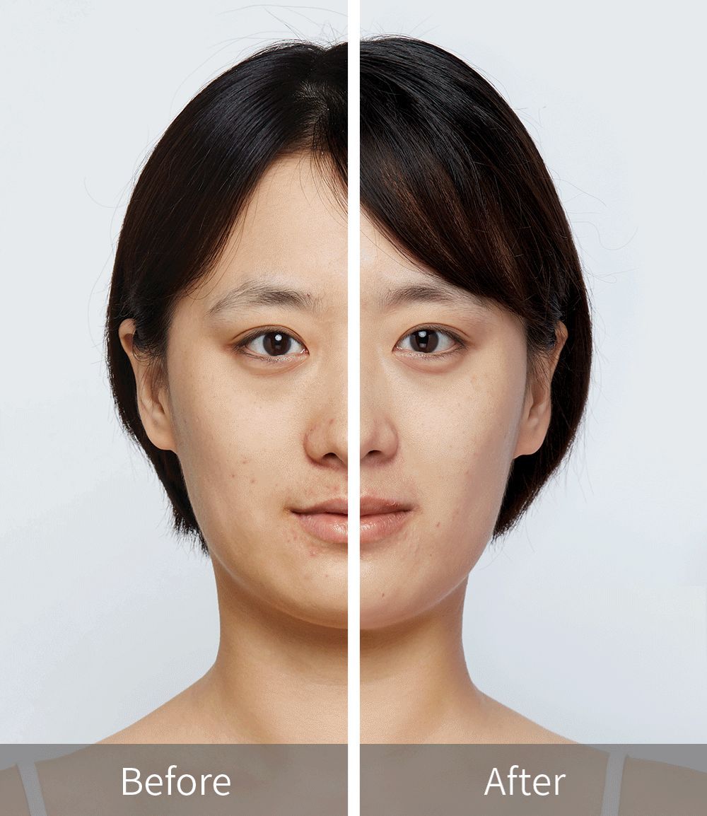解锁美食焕肤密码，养出天生牛奶肌