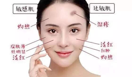 敏肌自救指南：改善敏感肌的关键要点