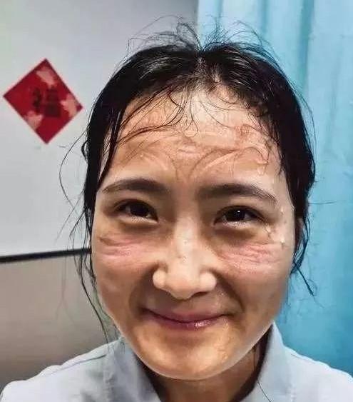 惊！皱纹突现非因老，竟是身体在报警