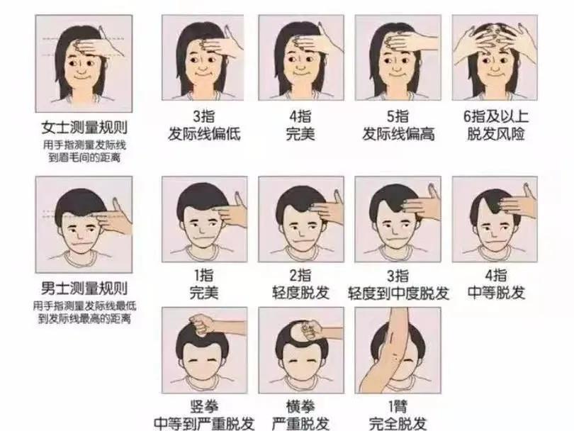 告别“秃”然！防脱洗发水挑选秘籍大公开