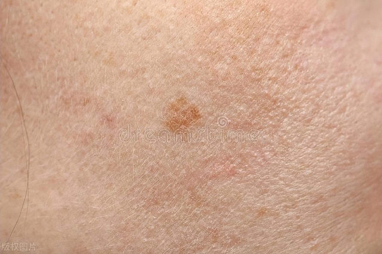 女性必知!身体发出的这些预警信号别忽视